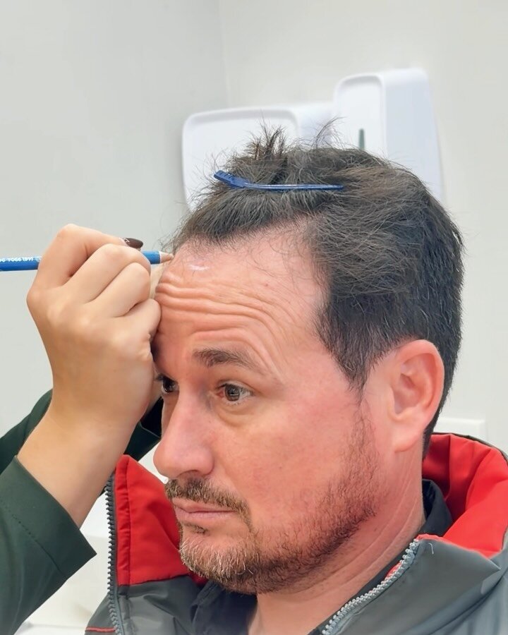 Planejamento da linha frontal